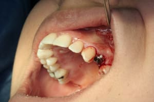Img 2754 lqbdew - Eugenol