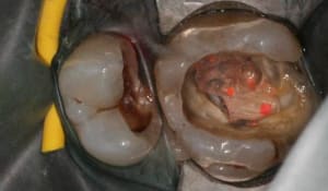 Img 2754 wuuc8q - Eugenol