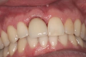 Img 3107 noobrm - Eugenol