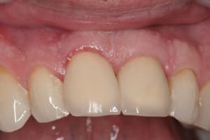 Img 3109 xzxhnx - Eugenol