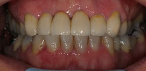 Img 3159 tiso3c - Eugenol