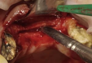 Img 3177rc gbek0b - Eugenol