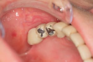 Img 3203 lsmsen - Eugenol
