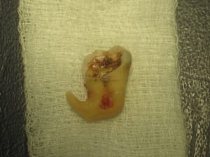 Img 3303 hax58i - Eugenol