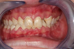 Img 3310 uzaqcc - Eugenol