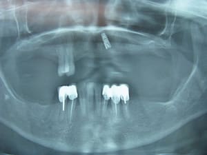 Img 3487 koz0uo - Eugenol