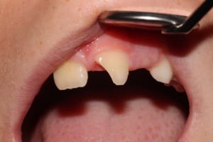 Img 3525 erhby4 - Eugenol