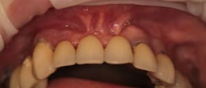 Img 3713 s6gprk - Eugenol