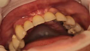 Img 3717 qoigjh - Eugenol