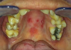 Img 3802 tmlfu1 - Eugenol
