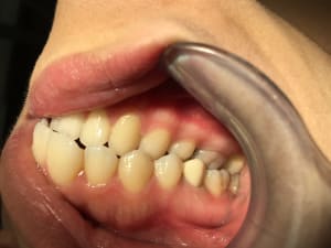 Img 3985 ggckjm - Eugenol