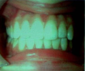 Img 3 lwvz7t - Eugenol