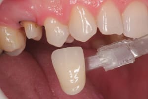 Img 4025 ceneom - Eugenol