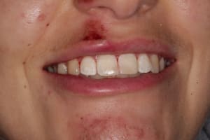 Img 4686 nne5uw - Eugenol