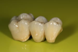 Img 4699 1 bolwft - Eugenol