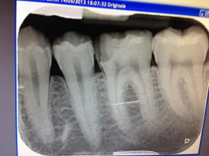 Img 4752 emfwu0 - Eugenol