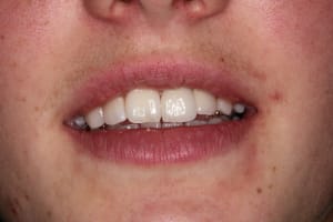 Img 4757 b7se3m - Eugenol