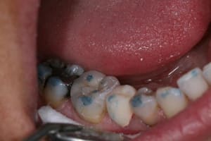 Img 4929 e67ugl - Eugenol