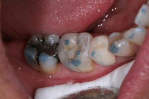 Img 4930 fmcy7v - Eugenol
