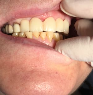 Img 5017 ibdvbo - Eugenol