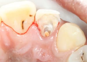 Img 5167b vbmxwm - Eugenol