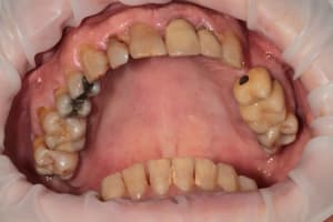 Img 5373 etwabz - Eugenol