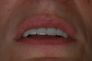 Img 5468 o7k7s9 - Eugenol