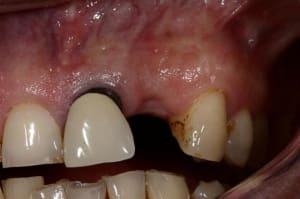 Img 5489  medium  r8wqmu - Eugenol