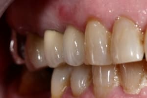 Img 5777 kdpzje - Eugenol