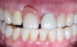Img 5804 rvn38o - Eugenol