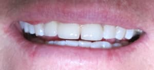 Img 5816 okgijh - Eugenol