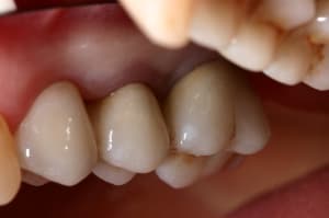 Img 5981 hjbpkc - Eugenol