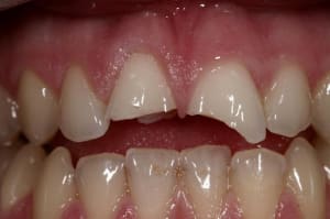 Img 6026  large  ukaa2d - Eugenol