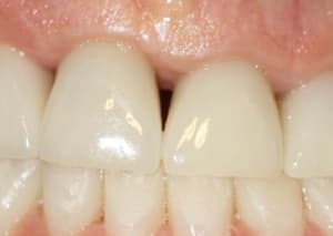 Img 6265 vjfkfa otgxyz - Eugenol