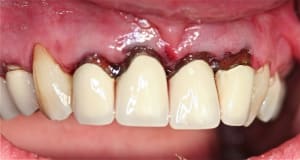 Img 6763 mkhxq0 - Eugenol