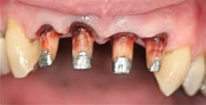 Img 6860 pgrzlb - Eugenol