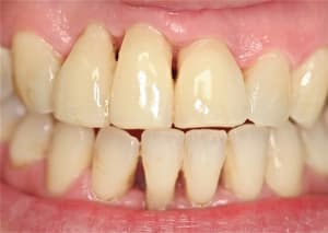 Img 6929 xjyl2c - Eugenol