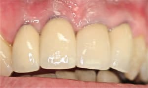 Img 6948 hmbuww - Eugenol