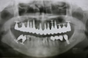 Img 7052 nmrbfs - Eugenol