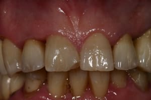 Img 7262 ipgisq - Eugenol