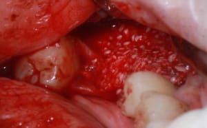 Img 7561r tqkwzz - Eugenol