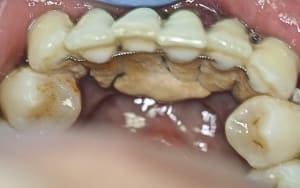 Img 7688 hidapf - Eugenol