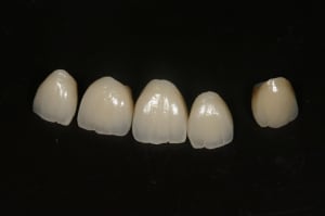 Img 7716 tqfsq0 - Eugenol