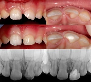 Img 7720  3  mkmbj0 - Eugenol