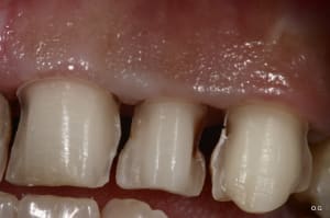Img 7736 pce6se - Eugenol