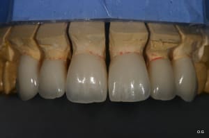 Img 7757 qicif8 - Eugenol