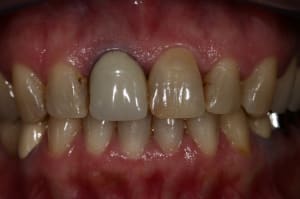 Img 8608 txq6il - Eugenol