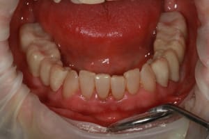 Img 8766 fgtkll - Eugenol