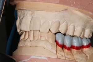 Img 8779 xqrohy - Eugenol