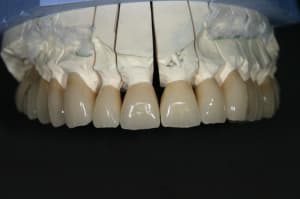 Img 9028 nhtg7u - Eugenol